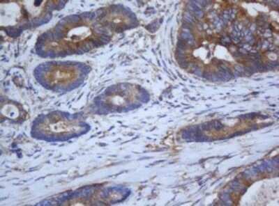 Immunohistochemistry: Calpain 2 Antibody (OTI3G1) - Azide and BSA Free [NBP2-70334]