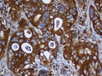 Immunohistochemistry: Calpain 2 Antibody (OTI3G1) - Azide and BSA Free [NBP2-70334]