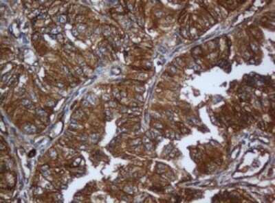 Immunohistochemistry: Calpain 2 Antibody (OTI3G1) - Azide and BSA Free [NBP2-70334]