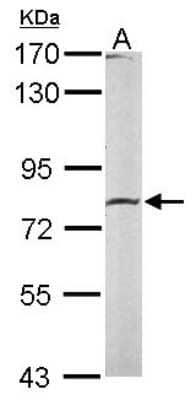 Western Blot: Calpain 2 Antibody [NBP2-15676]