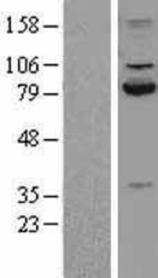 Western Blot: Calpain 2 Overexpression Lysate [NBL1-08680]