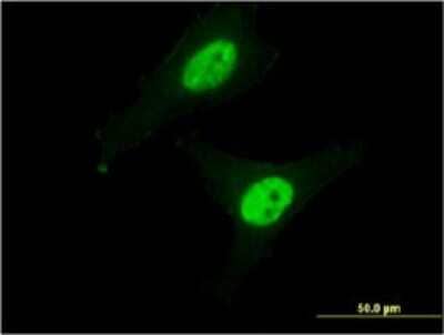 Immunocytochemistry/ Immunofluorescence: Calpain 3 Antibody (1B2) [H00000825-M01]