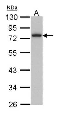 Western Blot: Calpain 3 Antibody [NBP1-31756]