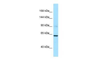 Western Blot: Calpain 3 Antibody [NBP2-87117]