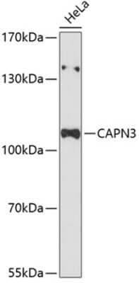 Western Blot: Calpain 3 AntibodyAzide and BSA Free [NBP2-92075]