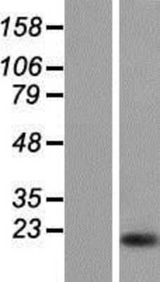 Western Blot: Calpain 3 Overexpression Lysate [NBP2-05152]