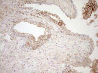 Immunohistochemistry: Calpain 5 Antibody (OTI7D2) [NBP2-46064]