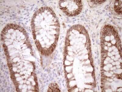 Immunohistochemistry: Calpain 5 Antibody (OTI7D2) - Azide and BSA Free [NBP2-70328]