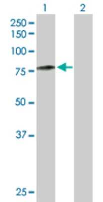 Western Blot: Calpain 5 Antibody [H00000726-D01P]