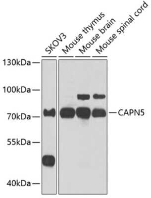 Western Blot: Calpain 5 AntibodyBSA Free [NBP2-92674]