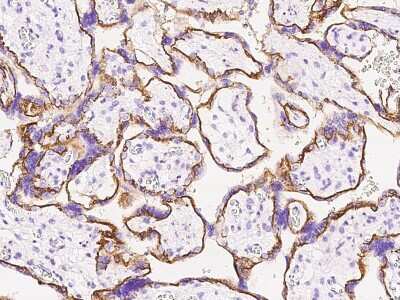 Immunohistochemistry-Paraffin: Calpain 6 Antibody [NBP2-99462]