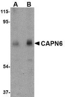 Western Blot: Calpain 6 AntibodyBSA Free [NBP1-76937]