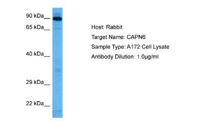 Western Blot: Calpain 6 Antibody [NBP2-84585]