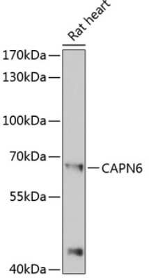 Western Blot: Calpain 6 AntibodyBSA Free [NBP2-92126]