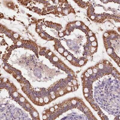 Immunohistochemistry-Paraffin: Calpain 7 Antibody [NBP2-14436]