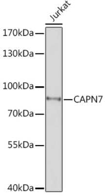 Western Blot: Calpain 7 AntibodyAzide and BSA Free [NBP3-15548]