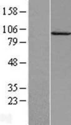 Western Blot: Calpain 7 Overexpression Lysate [NBL1-08683]