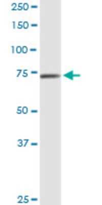 Western Blot: Calpain 9 Antibody (3A6) [H00010753-M02]