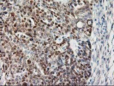 Immunohistochemistry-Paraffin: Calpain 9 Antibody (OTI3G10) [NBP2-01305]
