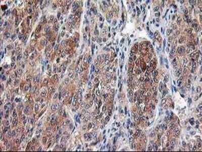 Immunohistochemistry-Paraffin: Calpain 9 Antibody (OTI3G10) [NBP2-01305]
