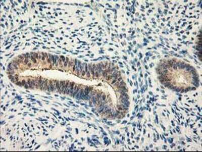 Immunohistochemistry-Paraffin: Calpain 9 Antibody (OTI3G10) [NBP2-01305]