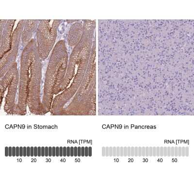 Immunohistochemistry-Paraffin: Calpain 9 Antibody [NBP2-48545]