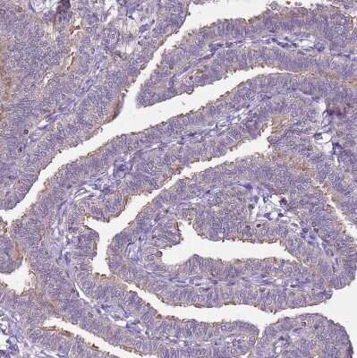 Immunohistochemistry-Paraffin: Calpain 9 Antibody [NBP2-48545]