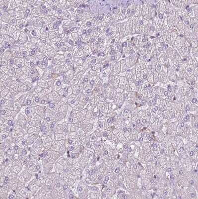 Immunohistochemistry-Paraffin: Calpain 9 Antibody [NBP2-48545]