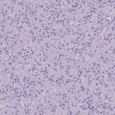 Immunohistochemistry-Paraffin: Calpain 9 Antibody [NBP2-48545]