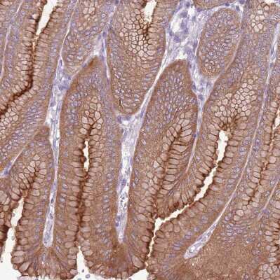 Immunohistochemistry-Paraffin: Calpain 9 Antibody [NBP2-48545]