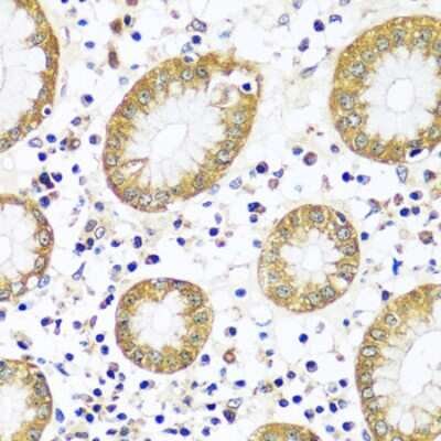 Immunohistochemistry-Paraffin: Calpain 9 Antibody - Azide and BSA Free [NBP3-03707]