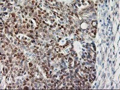 Immunohistochemistry: Calpain 9 Antibody (OTI3G10) - Azide and BSA Free [NBP2-71626]