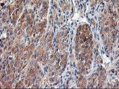 Immunohistochemistry: Calpain 9 Antibody (OTI3G10) - Azide and BSA Free [NBP2-71626]