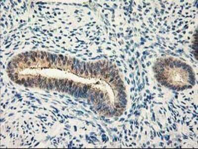 Immunohistochemistry: Calpain 9 Antibody (OTI3G10) - Azide and BSA Free [NBP2-71626]
