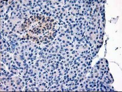 Immunohistochemistry: Calpain 9 Antibody (OTI3G10) - Azide and BSA Free [NBP2-71626]