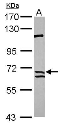 Western Blot: Calpain 9 Antibody [NBP2-14896]