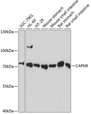 Western Blot: Calpain 9 AntibodyAzide and BSA Free [NBP2-92127]