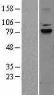 Western Blot: Calpain 9 Overexpression Lysate [NBL1-08684]