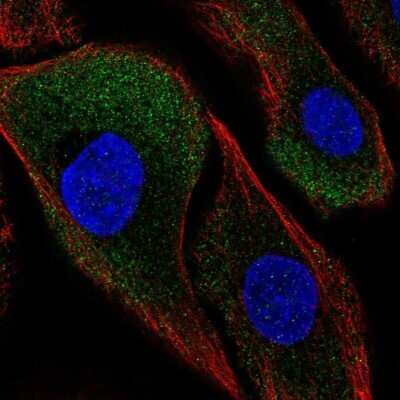 Immunocytochemistry/ Immunofluorescence: Calpain S2 Antibody [NBP2-68754]