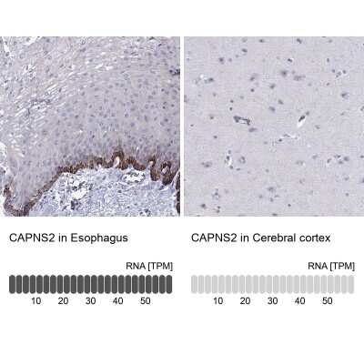 Immunohistochemistry-Paraffin: Calpain S2 Antibody [NBP2-62708]