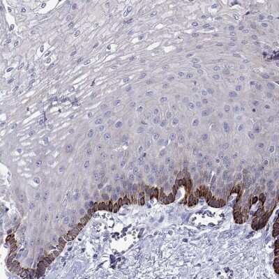 Immunohistochemistry-Paraffin: Calpain S2 Antibody [NBP2-62708]