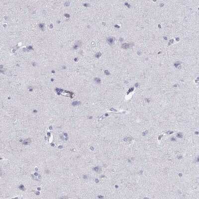 Immunohistochemistry-Paraffin: Calpain S2 Antibody [NBP2-62708]