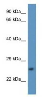 Western Blot: Calpain S2 Antibody [NBP1-79818]