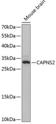 Western Blot: Calpain S2 AntibodyAzide and BSA Free [NBP3-03218]