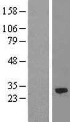 Western Blot: Calpain S2 Overexpression Lysate [NBL1-08686]