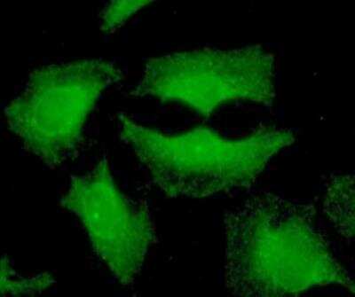 Immunocytochemistry/ Immunofluorescence: Calpain S1 Antibody (1D11) - BSA Free [NBP2-59446]