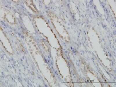 Immunohistochemistry-Paraffin: Calpain S1 Antibody (3C4) [H00000826-M01]
