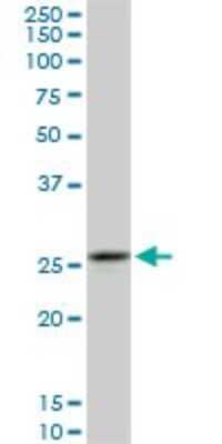 Western Blot: Calpain S1 Antibody (3C4) [H00000826-M01]
