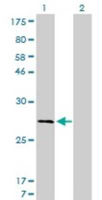 Western Blot: Calpain S1 Antibody (3C4) [H00000826-M01]