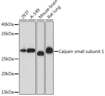 Western Blot: Calpain S1 Antibody (5X8H4) [NBP3-16711]